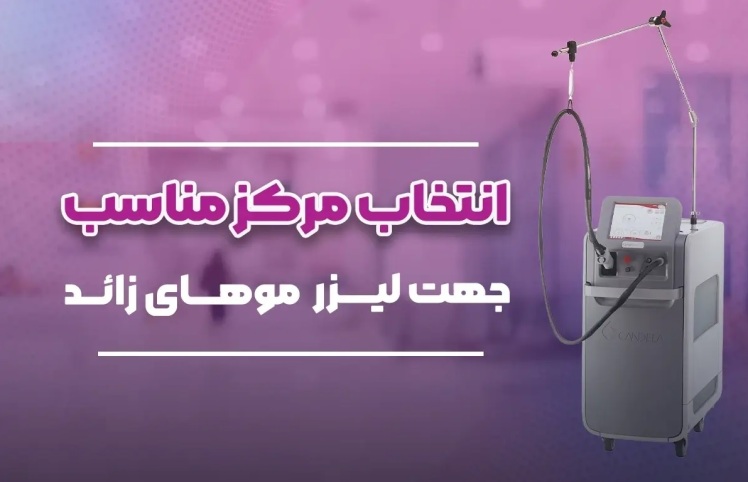 اصالت لیزر کندلا مهراد