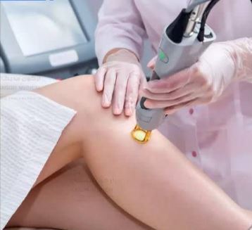 اشتباهات رایج قبل و بعد از لیزر موهای زائد (توصیه کلینیک مهراد زنجان)