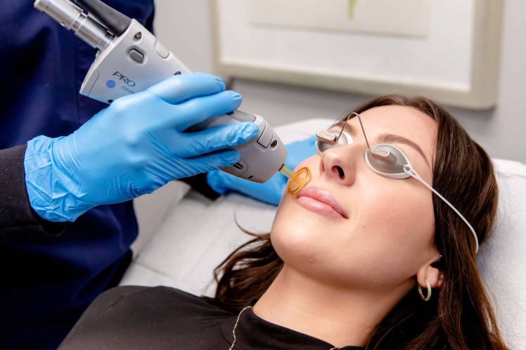 مراقبتهای قبل و بعد از لیزر کندلا برای نتیجه بهتر